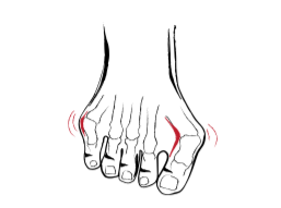 foot-therapy-1